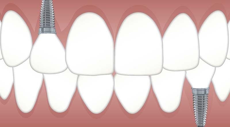 Behandlung beim Zahnarzt - Lizenzfrei